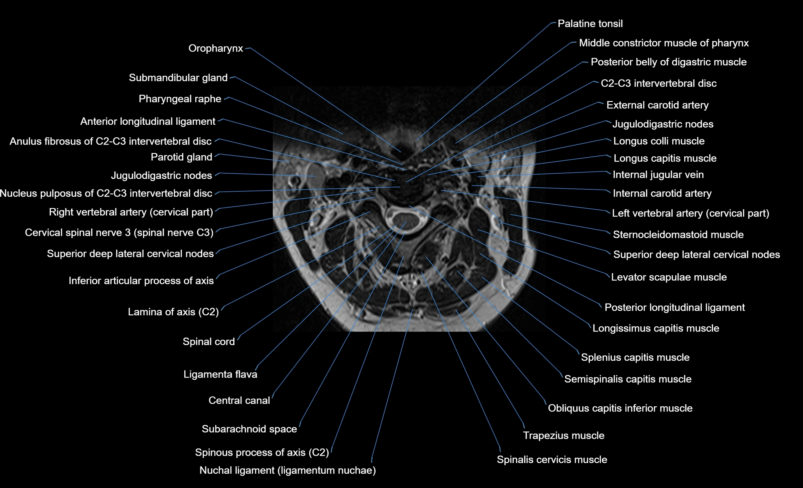 cervical spine cross sectional MRI anatomy  3T MRI axial  image-img-00001-00014.webp